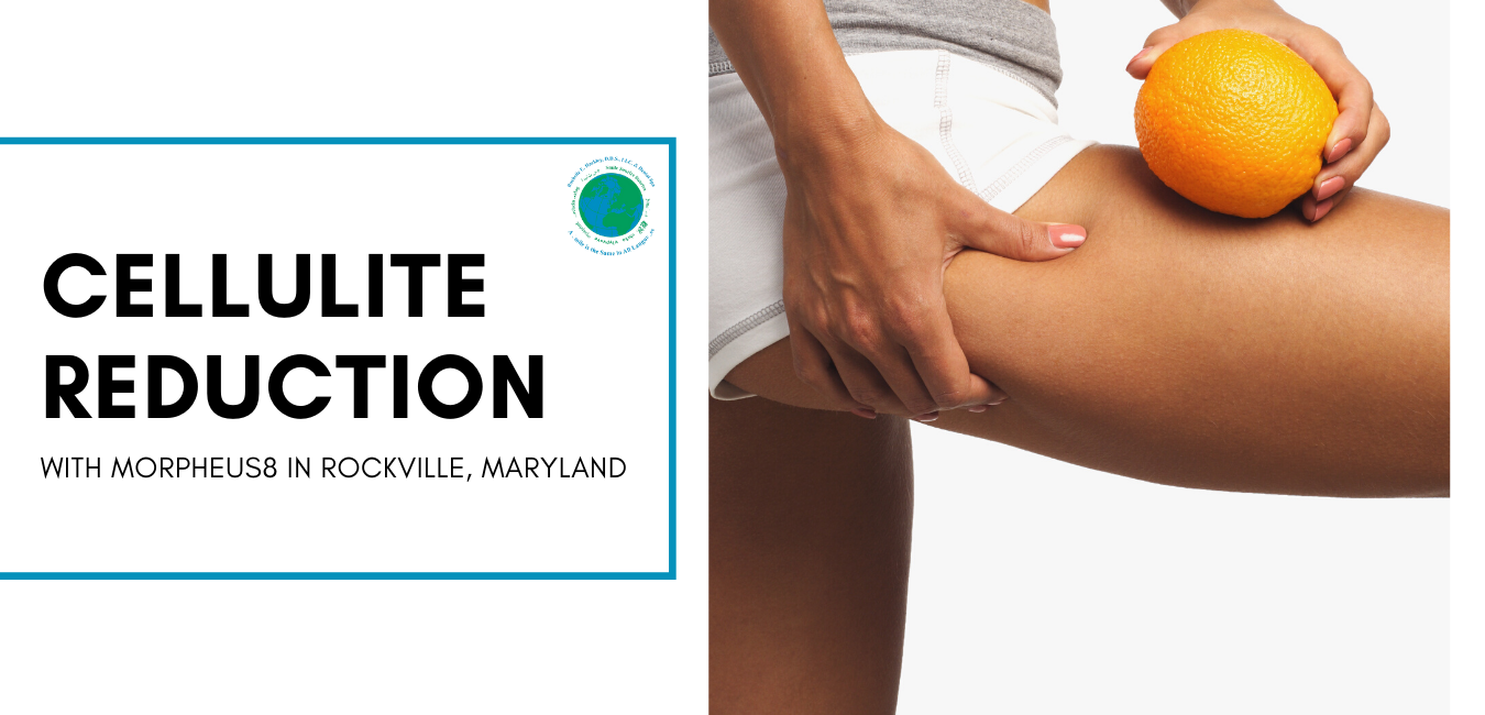 Cellulite Reduction Rockville Maryland