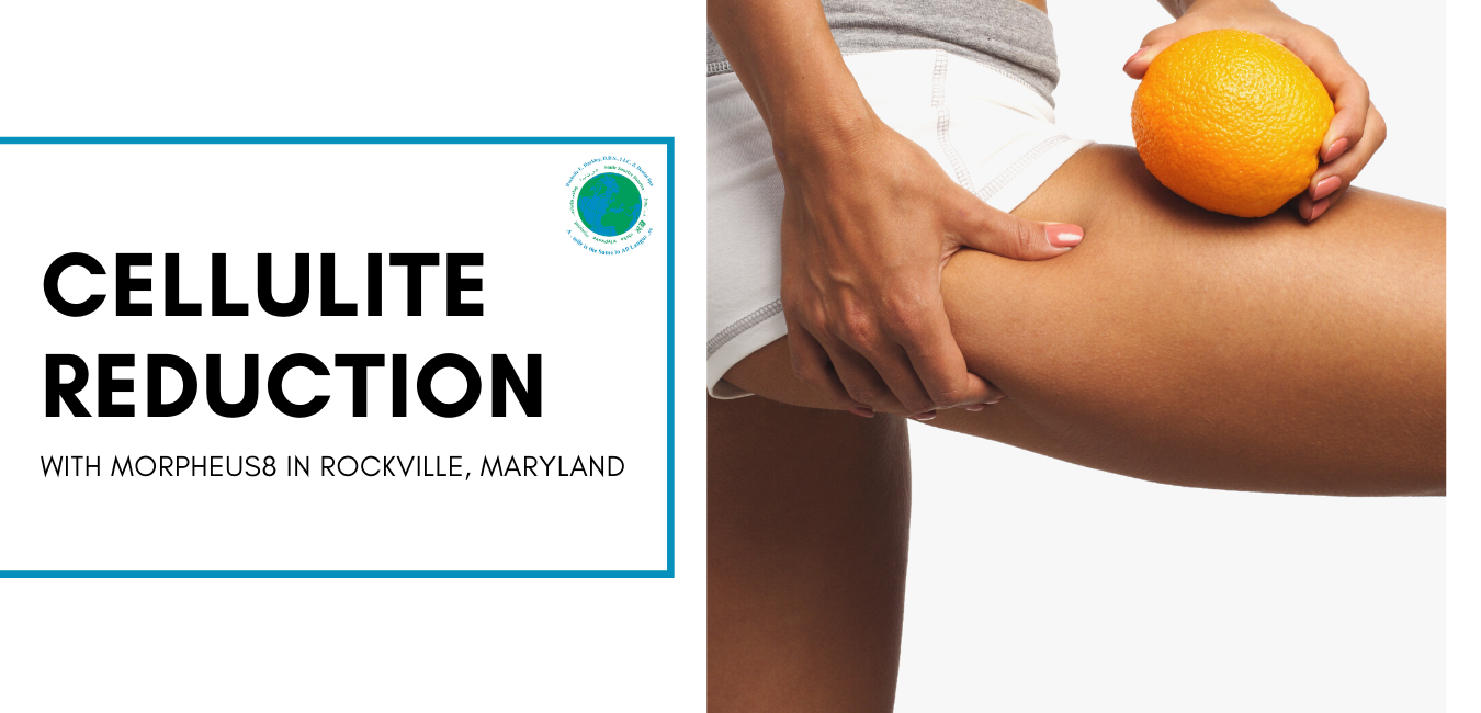 Cellulite Reduction