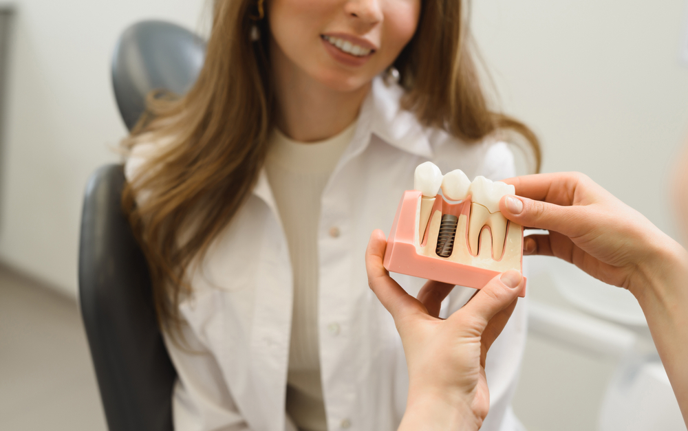 Tooth Implant Specialist in Rockville