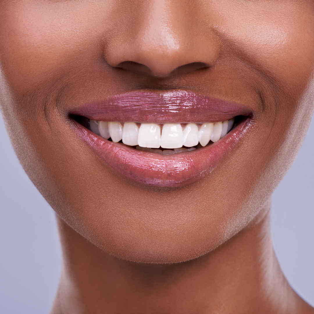 Rockville Teeth Whitening FAQ
