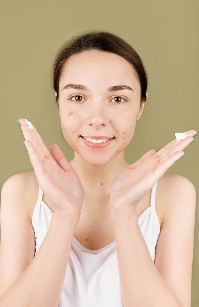 hydrafacials for acne in Rockville
